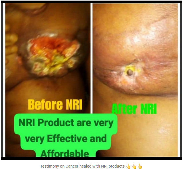 Breast Cancer Testimony
